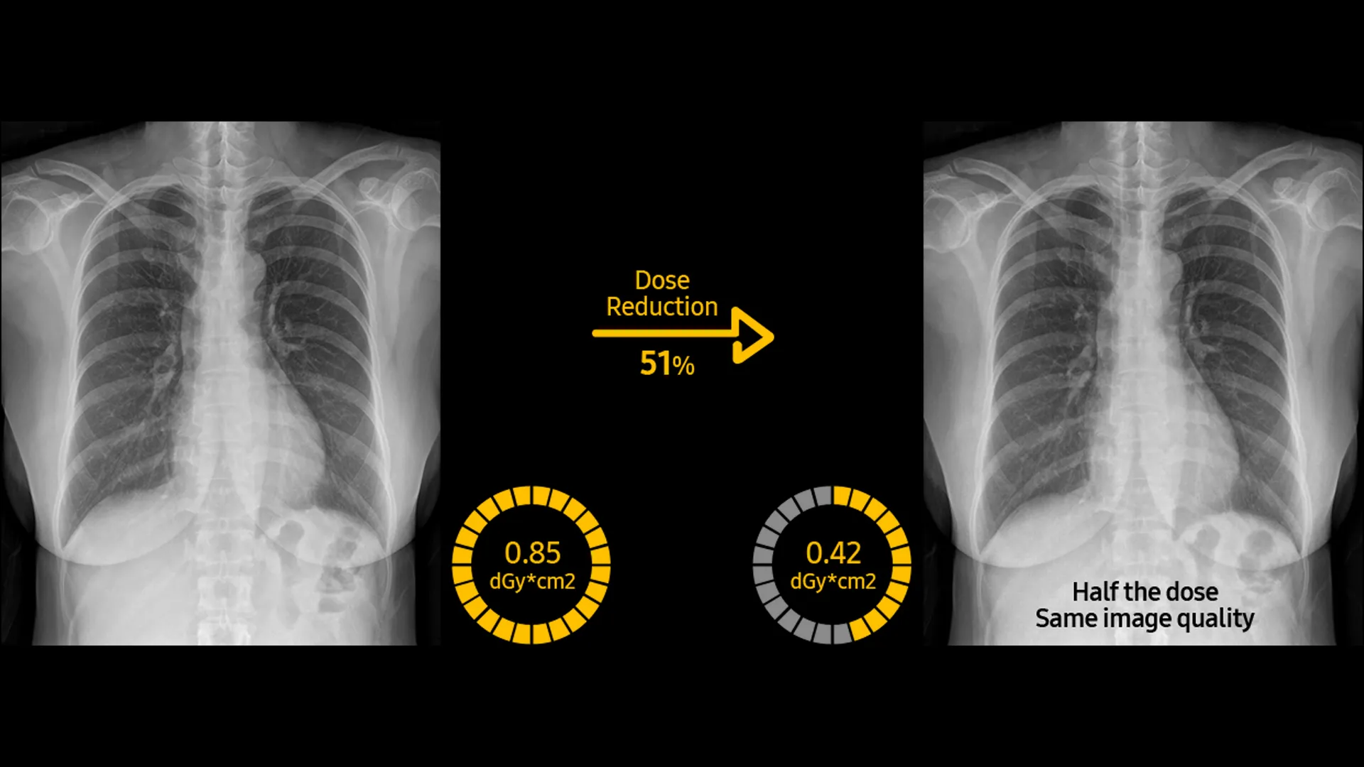 Xray-about-eqipment