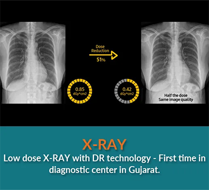 Xray