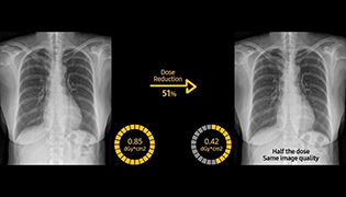 Digital X-Ray: Why is it
                                    Performed?