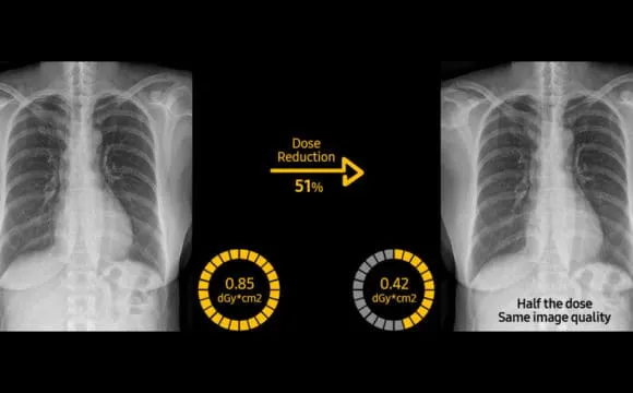 Digital X-RAY (DR)