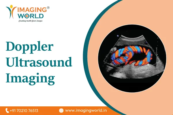 Doppler Ultrasound Imaging