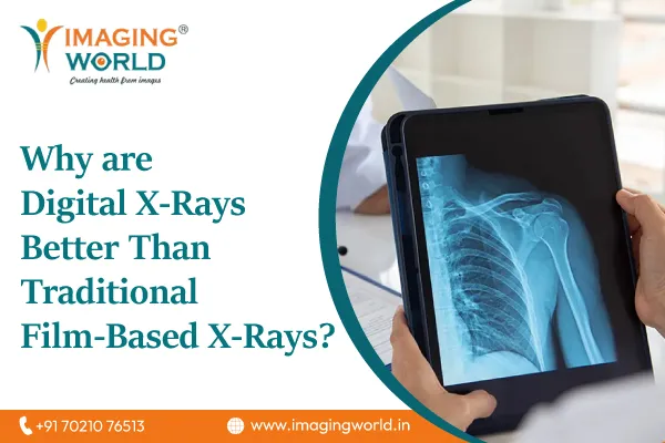 Digital X-Rays