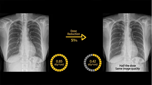 digital-x-ray-price-in-bopal-ahmedabad