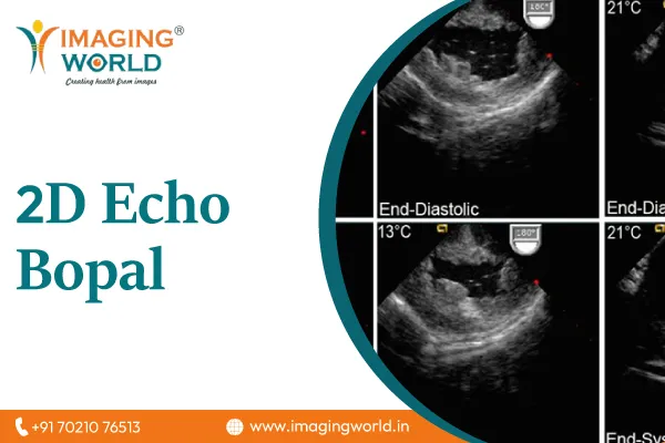 2D Echo Bopal