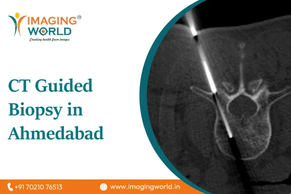 CT Guided Biopsy in Ahmedabad