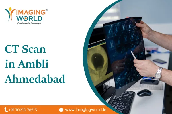 CT Scan in Ambli Ahmedabad