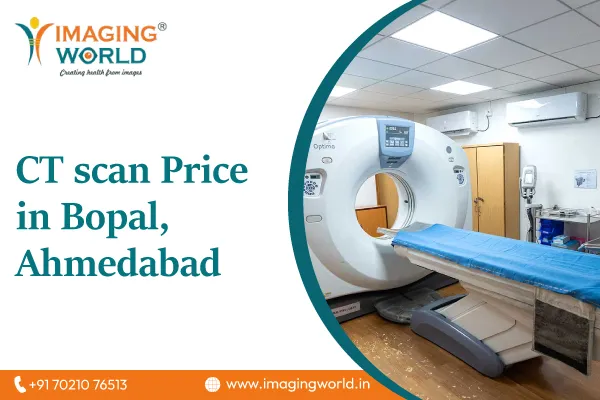 CT Scan Price in Bopal, Ahmedabad