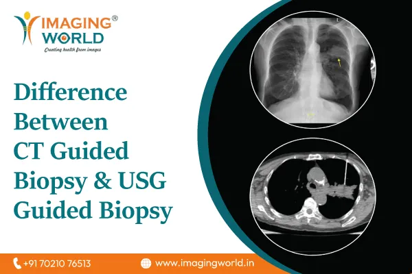 ct-guided-biopsy-&-usg-guided-biopsy