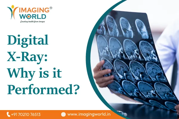 Digital X-Ray: Why is it
                                    Performed?
