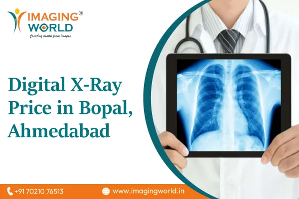 digital-x-ray-price-in-bopal-ahmedabad