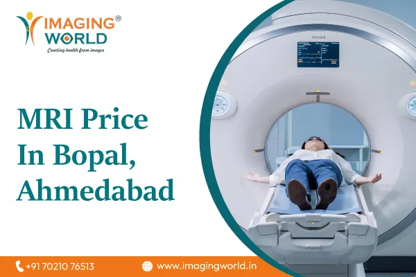 MRI Price In Bopal, Ahmedabad