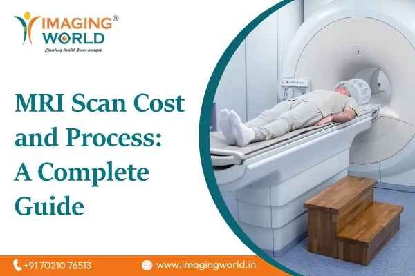 MRI Scan