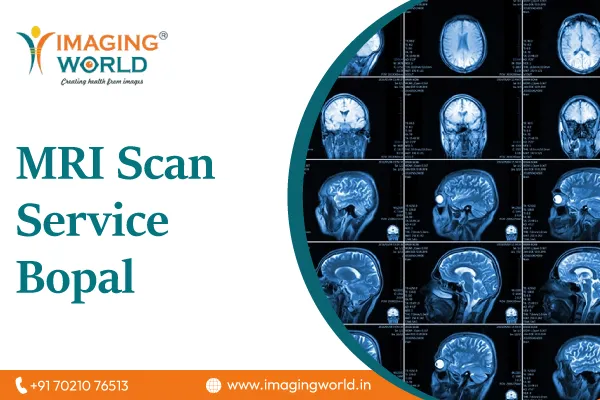 MRI Scan Service Bopal