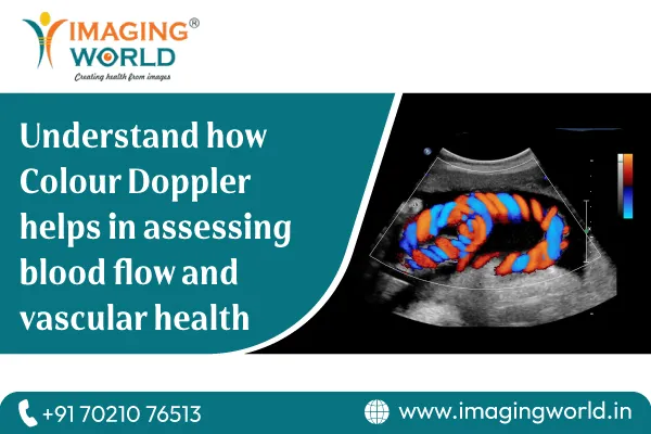 Understanding Colour Doppler: Advanced Blood Flow Assessment